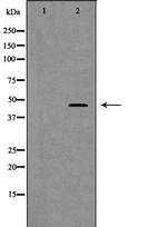 DP1 Polyclonal Antibody