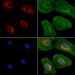 Lamin B Receptor Antibody in Immunocytochemistry (ICC/IF)