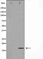 Myoglobin Polyclonal Antibody