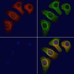 PSRC1 Polyclonal Antibody