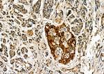 PSRC1 Antibody in Immunohistochemistry (Paraffin) (IHC (P))