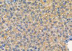 SNRPE Polyclonal Antibody