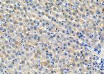 SNRPE Antibody in Immunohistochemistry (Paraffin) (IHC (P))