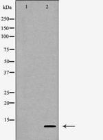 SNRPE Antibody in Western Blot (WB)