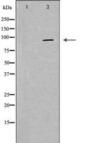 PKP2 Polyclonal Antibody