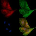 UGT1A4 Polyclonal Antibody