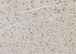 RPLP0 Antibody in Immunohistochemistry (Paraffin) (IHC (P))