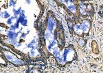 RPLP0 Antibody in Immunohistochemistry (Paraffin) (IHC (P))
