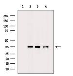 RPLP0 Antibody in Western Blot (WB)