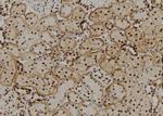 CRYBB2 Antibody in Immunohistochemistry (Paraffin) (IHC (P))