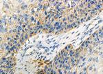 CRYBB2 Polyclonal Antibody