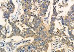 CRYBB2 Antibody in Immunohistochemistry (Paraffin) (IHC (P))