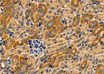 CRYBB2 Antibody in Immunohistochemistry (Paraffin) (IHC (P))