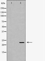 CRYBB2 Antibody in Western Blot (WB)