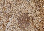 SKIV2L2 Polyclonal Antibody