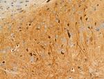 MLKL Antibody in Immunohistochemistry (Paraffin) (IHC (P))
