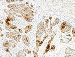 MLKL Antibody in Immunohistochemistry (Paraffin) (IHC (P))