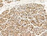 MLKL Antibody in Immunohistochemistry (Paraffin) (IHC (P))
