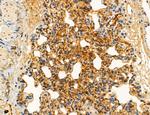 MLKL Antibody in Immunohistochemistry (Paraffin) (IHC (P))