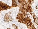 MLKL Antibody in Immunohistochemistry (Paraffin) (IHC (P))