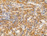 MLKL Antibody in Immunohistochemistry (Paraffin) (IHC (P))