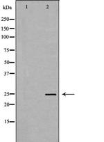 TK1 Polyclonal Antibody