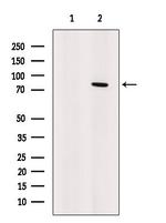 Artemis Polyclonal Antibody