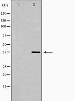 LSP1 Polyclonal Antibody