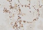 RAG2 Polyclonal Antibody