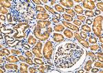 PLTP Antibody in Immunohistochemistry (Paraffin) (IHC (P))