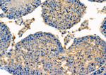 PLTP Antibody in Immunohistochemistry (Paraffin) (IHC (P))