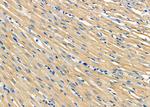 PLTP Antibody in Immunohistochemistry (Paraffin) (IHC (P))