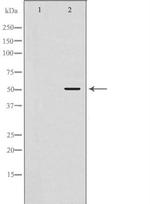 Fibrinogen gamma Polyclonal Antibody