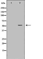 HTR3A Polyclonal Antibody