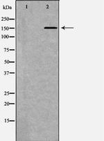 ATP7B Polyclonal Antibody