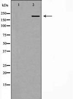PCM1 Polyclonal Antibody