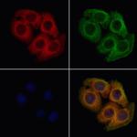 ATP1B1 Polyclonal Antibody