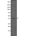 ADH6 Polyclonal Antibody