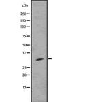 SPRY4 Antibody in Western Blot (WB)
