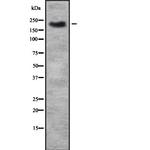TRPM7 Antibody in Western Blot (WB)