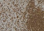 Claspin Polyclonal Antibody