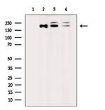 RICTOR Antibody in Western Blot (WB)