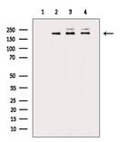 RICTOR Polyclonal Antibody