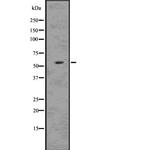 MDMX Antibody in Western Blot (WB)