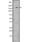 IRS2 Polyclonal Antibody
