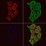 CSNK2B Polyclonal Antibody