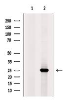 CSNK2B Antibody in Western Blot (WB)