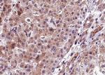 Phospho-PERK (Thr982) Antibody in Immunohistochemistry (Paraffin) (IHC (P))