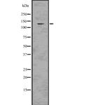 CARD11 Polyclonal Antibody