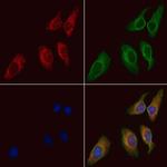 ARHGAP5 Polyclonal Antibody